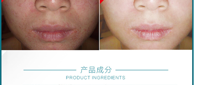 �����t(y��)���w���ޏ�(f��)˪