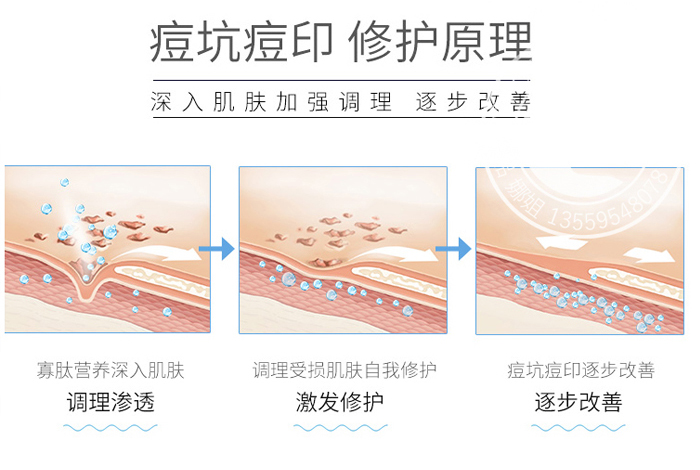 凍干粉OEM_03 凍干粉OEM_03